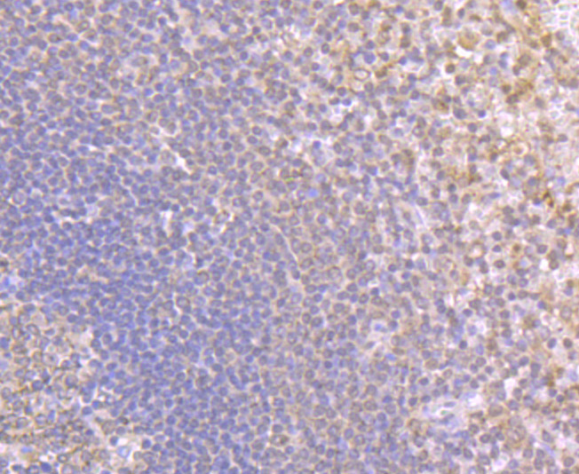 Fig6: Immunohistochemical analysis of paraffin-embedded human spleen tissue using anti-NLRC3 antibody. Counter stained with hematoxylin.