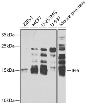Western blot - IFI6 Polyclonal Antibody 