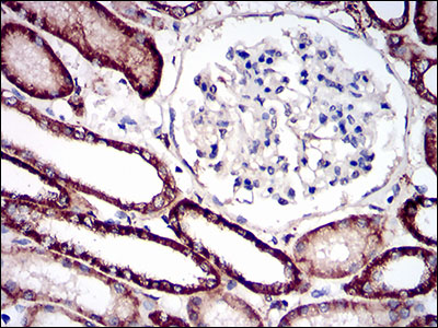 Immunohistochemical analysis of paraffin-embedded kidney tissues using CDH16 mouse mAb with DAB staining.