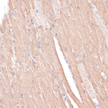 Immunohistochemistry - KCNK1 Polyclonal Antibody 