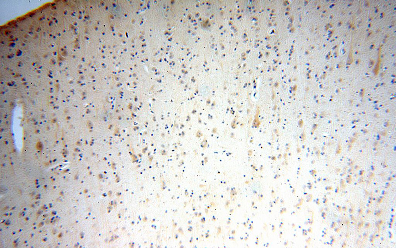 Immunohistochemical of paraffin-embedded human brain using Catalog No:111614(IFFO1 antibody) at dilution of 1:100 (under 10x lens)