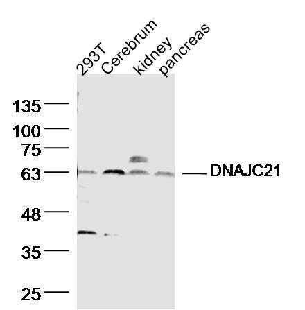 Fig1: Sample:; 293T (human)Cell Lysate at 40 ug; Cerebrum (mouse) Lysate at 40 ug; kidney (mouse) Lysate at 40 ug; pancreas (mouse) Lysate at 40 ug; Primary: Anti- DNAJC21 at 1/300 dilution; Secondary: IRDye800CW Goat Anti-Rabbit IgG at 1/20000 dilution; Predicted band size: 62kD; Observed band size: 62kD