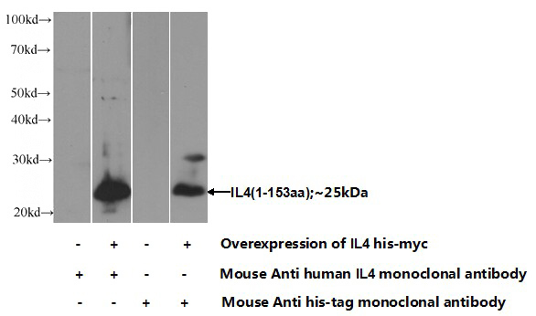 Transfected HEK-293 cells were subjected to SDS PAGE followed by western blot with Catalog No:107401(IL4 Antibody) at dilution of 1:1000