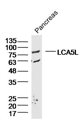 Fig1: Sample: Pancreas (Mouse) Lysate at 40 ug; Primary: Anti-LCA5L at 1/300 dilution; Secondary: IRDye800CW Goat Anti-Rabbit IgG at 1/20000 dilution; Predicted band size: 77kD; Observed band size: 77kD