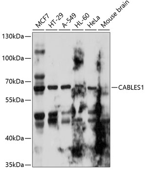 Western blot - CABLES1 Polyclonal Antibody 
