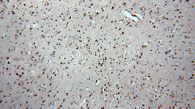 Immunohistochemical of paraffin-embedded human brain using Catalog No:115463(SNRPE antibody) at dilution of 1:50 (under 10x lens)