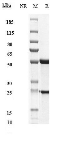 SDS-PAGE