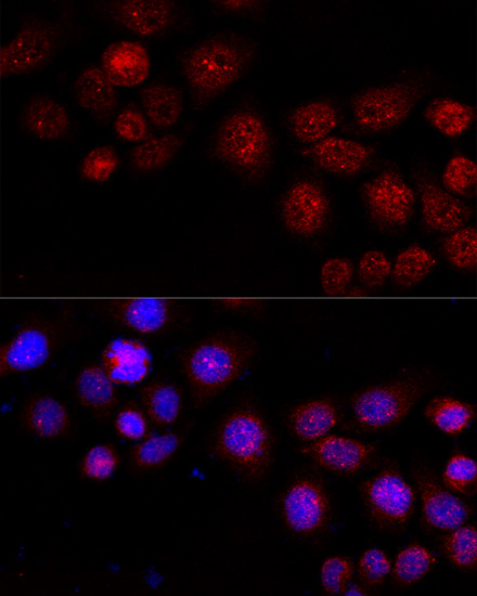 Immunofluorescence - CXCR4 Polyclonal Antibody 