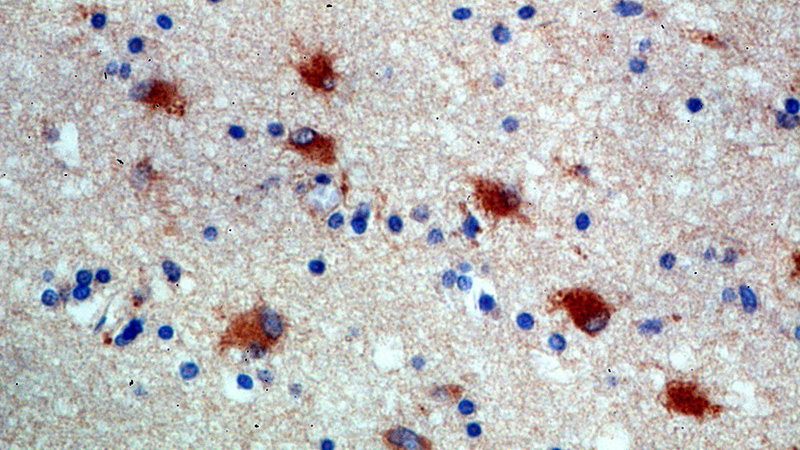 Immunohistochemical of paraffin-embedded human brain using Catalog No:115808(STXBP1 antibody) at dilution of 1:100 (under 40x lens)