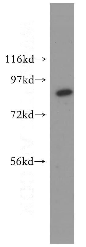 HEK-293 cells were subjected to SDS PAGE followed by western blot with Catalog No:112676(MLH1 antibody) at dilution of 1:500