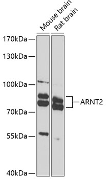 Western blot - ARNT2 Polyclonal Antibody 
