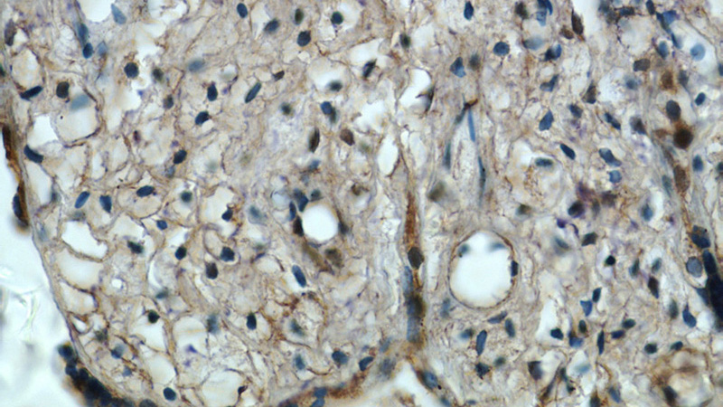 Immunohistochemistry of paraffin-embedded human placenta tissue slide using Catalog No:112043(FAM30A Antibody) at dilution of 1:50 (under 40x lens)