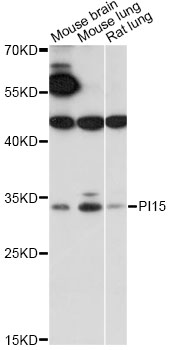 Western blot - PI15 Polyclonal Antibody 