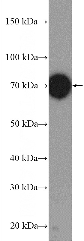 mouse liver tissue were subjected to SDS PAGE followed by western blot with Catalog No:116542(UBE3C Antibody) at dilution of 1:300