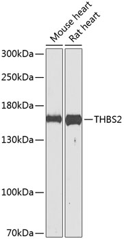 Western blot - THBS2 Polyclonal Antibody 