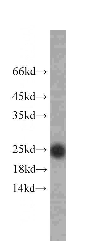 HeLa cells were subjected to SDS PAGE followed by western blot with Catalog No:107144(CD9 antibody) at dilution of 1:1000