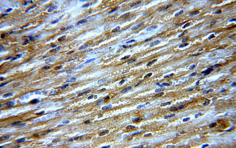 Immunohistochemical of paraffin-embedded human heart using Catalog No:113214(NPHP4 antibody) at dilution of 1:50 (under 40x lens)