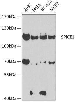 Western blot - SPICE1 Polyclonal Antibody 