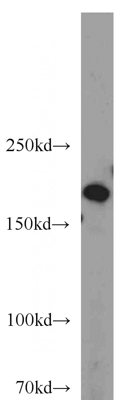 HEK-293 cells were subjected to SDS PAGE followed by western blot with Catalog No:109976(DocK1 antibody) at dilution of 1:1000