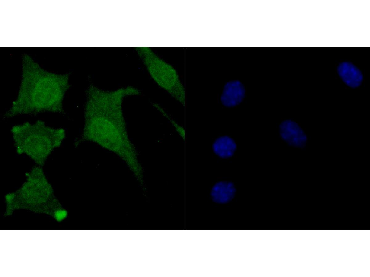 Fig4:; ICC staining of USP11 in SH-SY5Y cells (green). Formalin fixed cells were permeabilized with 0.1% Triton X-100 in TBS for 10 minutes at room temperature and blocked with 10% negative goat serum for 15 minutes at room temperature. Cells were probed with the primary antibody ( 1/50) for 1 hour at room temperature, washed with PBS. Alexa Fluor®488 conjugate-Goat anti-Rabbit IgG was used as the secondary antibody at 1/1,000 dilution. The nuclear counter stain is DAPI (blue).