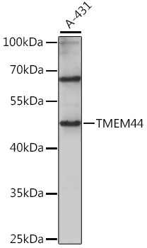 Western blot - TMEM44 Polyclonal Antibody 