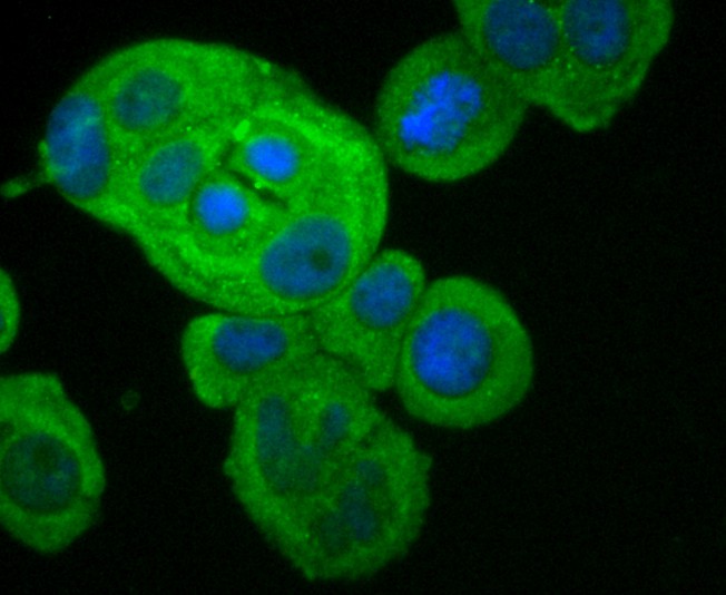 Fig4: ICC staining FPR1 in MCF-7 cells (green). The nuclear counter stain is DAPI (blue). Cells were fixed in paraformaldehyde, permeabilised with 0.25% Triton X100/PBS.