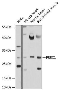 Western blot - PRRX1 Polyclonal Antibody 