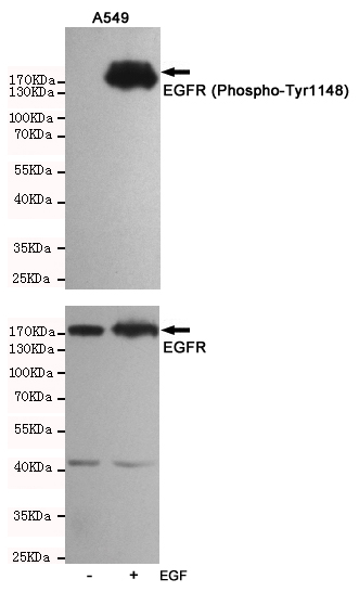 Western blot analysis of extracts from A549 cells, untreated or treated with EGF(10ng/ml,10min), using EGFR (Phospho-Tyr1148) Rabbit pAb (167121,1:500 diluted,upper) and EGF Receptor Mouse mAb (201012-3F12,lower).