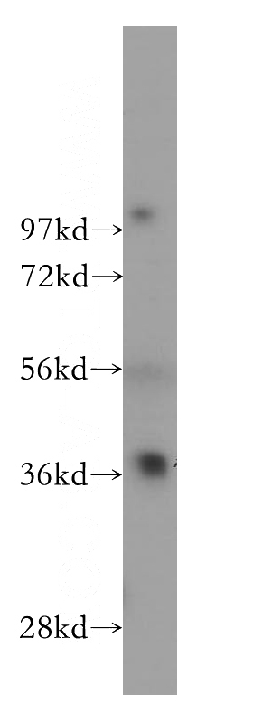 Jurkat cells were subjected to SDS PAGE followed by western blot with Catalog No:110973(GIMAP4 antibody) at dilution of 1:1000