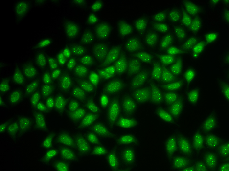 Immunofluorescence - Coilin Polyclonal Antibody 