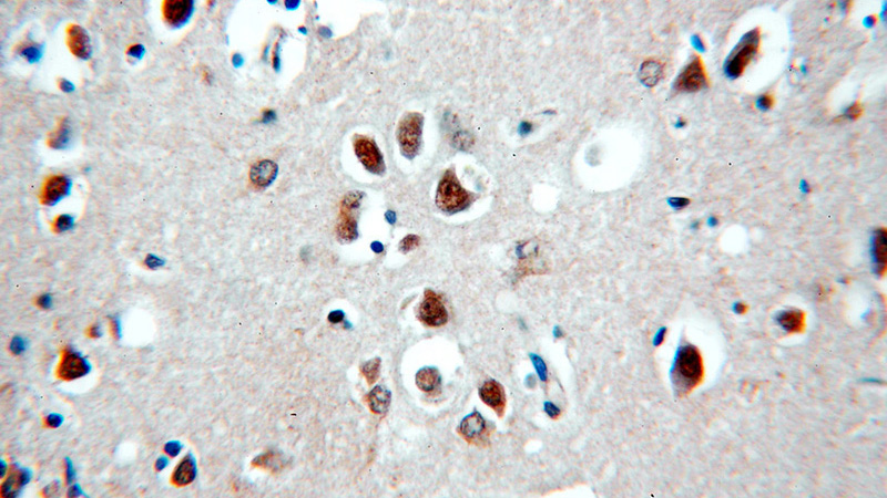 Immunohistochemical of paraffin-embedded human brain using Catalog No:111355(HIP1-Specific antibody) at dilution of 1:100 (under 40x lens)
