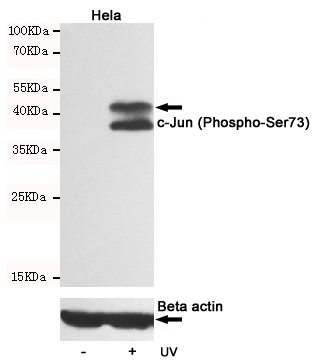 Western blot analysis of extracts from Hela cells, untreated or treated with UV, using c-Jun (Phospho-Ser73) Rabbit pAb (167147,1:500 diluted,upper) or Beta actin Mouse mAb (200068-8F10,lower).