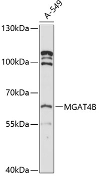 Western blot - MGAT4B Polyclonal Antibody 