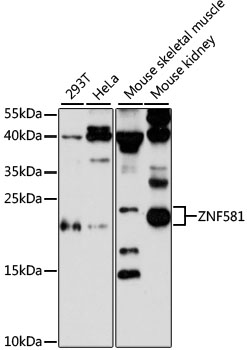 Western blot - ZNF581 Polyclonal Antibody 