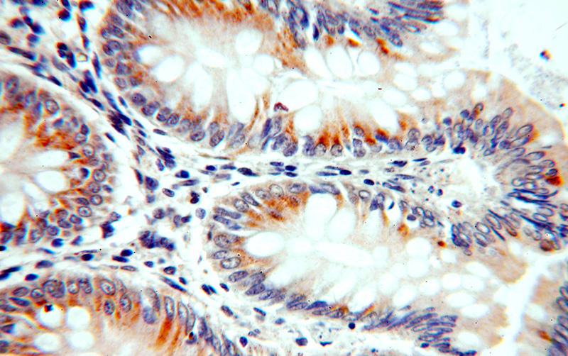 Immunohistochemical of paraffin-embedded human colon using Catalog No:108693(C20orf149 antibody) at dilution of 1:100 (under 40x lens)