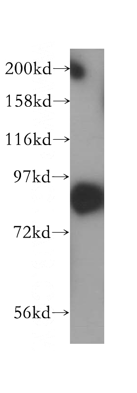 human brain tissue were subjected to SDS PAGE followed by western blot with Catalog No:115083(SEC6 antibody) at dilution of 1:86