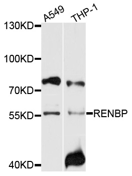 Western blot - RENBP Polyclonal Antibody 