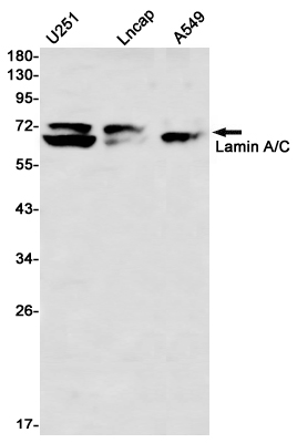 Western blot detection of Lamin A/C in U251,Lncap,A549 using Lamin A/C Rabbit mAb(1:1000 diluted)