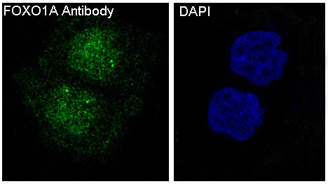 Immunofluorescent analysis of Hela cells, using FoxO1a Antibody .