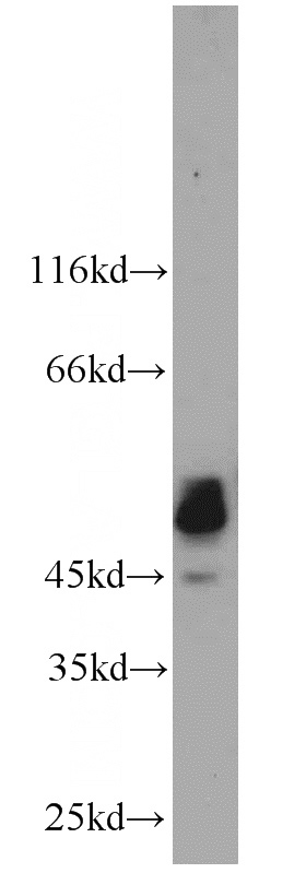 mouse thymus tissue were subjected to SDS PAGE followed by western blot with Catalog No:114318(PTPN2 antibody) at dilution of 1:1000