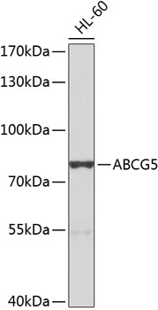 Western blot - ABCG5 Polyclonal Antibody 
