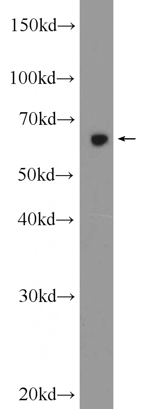 mouse ovary tissue were subjected to SDS PAGE followed by western blot with Catalog No:117017(ZNF654 Antibody) at dilution of 1:600