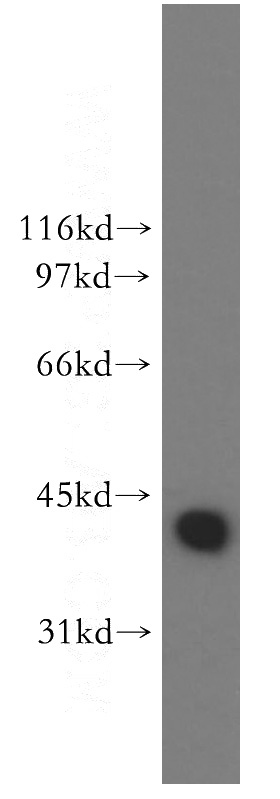 mouse spleen tissue were subjected to SDS PAGE followed by western blot with Catalog No:110088(DNAJB1 antibody) at dilution of 1:600