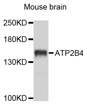 Western blot - ATP2B4 Polyclonal Antibody 
