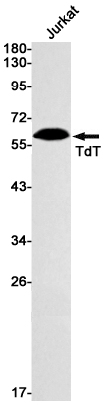 Western blot detection of TdT in Jurkat cell lysates using TdT Rabbit mAb(1:1000 diluted).Predicted band size:59kDa.Observed band size:59kDa.