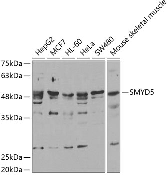 Western blot - SMYD5 Polyclonal Antibody 