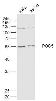 Fig2: Sample:; Hela(Human) Cell Lysate at 30 ug; Jurkat(Human) Cell Lysate at 30 ug; Primary: Anti-POC5 at 1/1000 dilution; Secondary: IRDye800CW Goat Anti-Rabbit IgG at 1/20000 dilution; Predicted band size: 60/43 kD; Observed band size: 63 kD