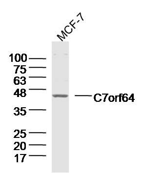 Fig2: Sample:MCF-7 Cell (Human) Lysate at 40 ug; Primary: Anti-C7orf64 at 1/300 dilution; Secondary: IRDye800CW Goat Anti-Rabbit IgG at 1/20000 dilution; Predicted band size: 42kD; Observed band size: 42kD