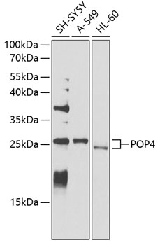 Western blot - POP4 Polyclonal Antibody 
