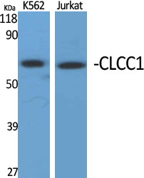 Fig1:; Western Blot analysis of various cells using CLCC1 Polyclonal Antibody diluted at 1: 1000